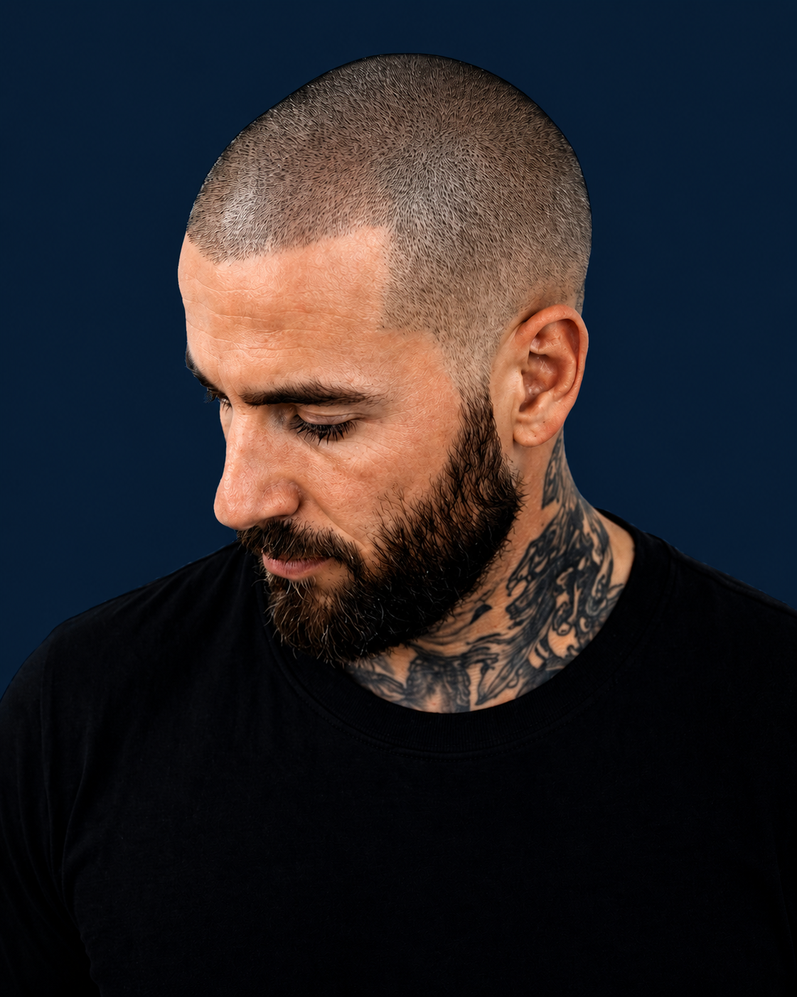 Man with shaved scalp showing natural scalp micro pigmentation style